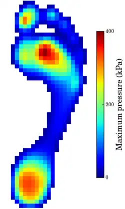 Example foot pressure
