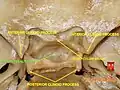 Base of skull - tuberculum sellae and hypophyseal fossa