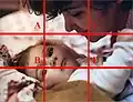 مثالی که در آن برای قرار دادن نقاط طلایی ABCD در ویژگی‌های قابل توجه تصویر انتخاب شده است به طوری که ناظر در مسیر بصری که از نقطه طلایی B شروع می‌شود، از نقطه طلایی C عبور می‌کند و در یک مسیر بی‌نهایت به A باز می‌گردد هدایت می‌شود.