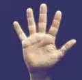 ۵