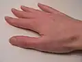 بهبودی