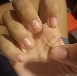 دست زنانه