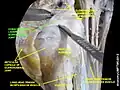 Dissection image of coracohumeral ligament of glenohumeral joint in green.