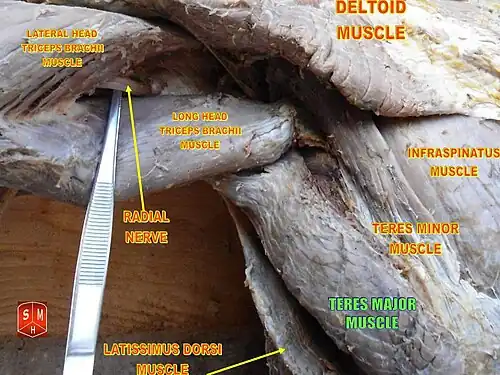 ماهیچه گرد بزرگ